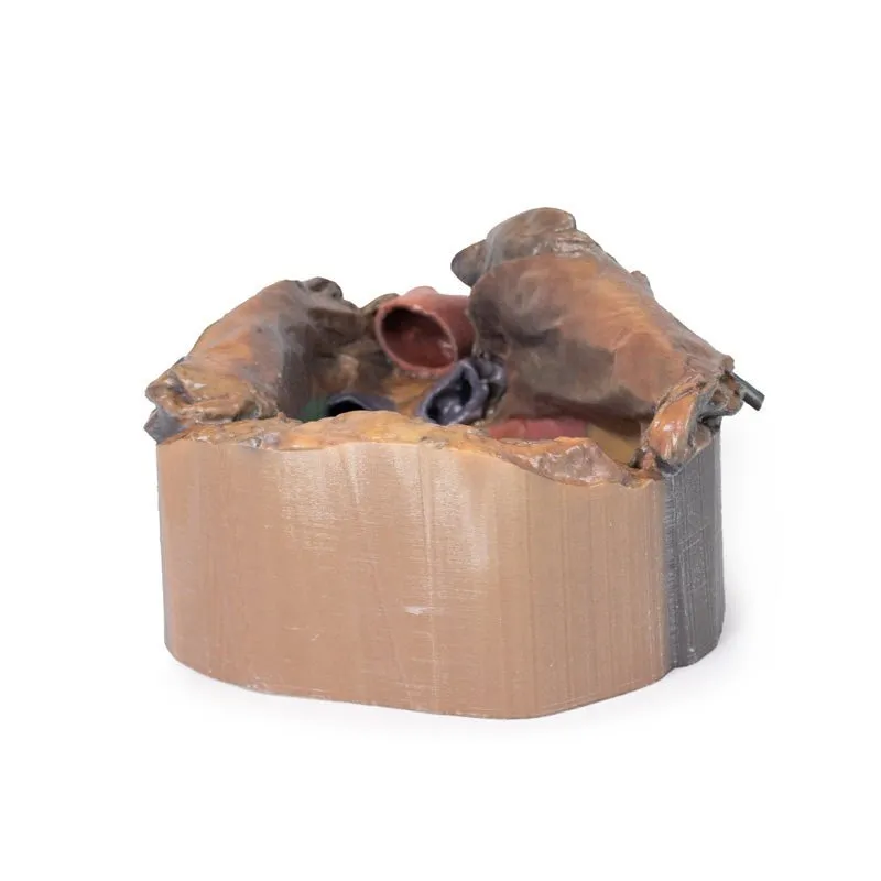 3D Printed Pericardial Space