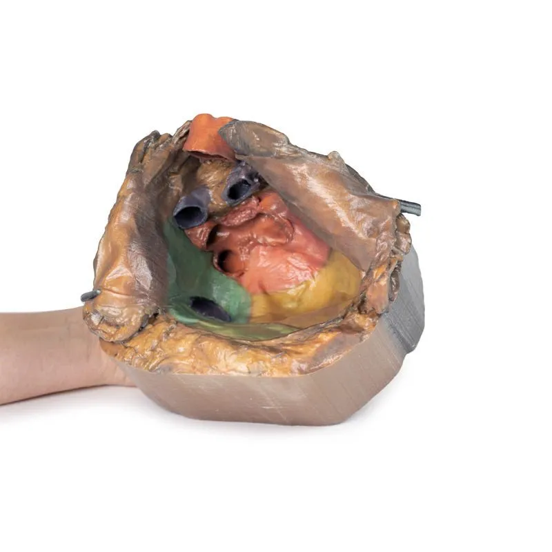 3D Printed Pericardial Space