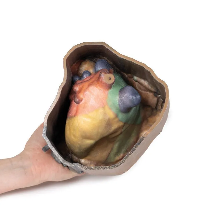 3D Printed Pericardial Space