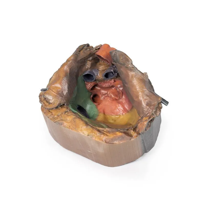 3D Printed Pericardial Space