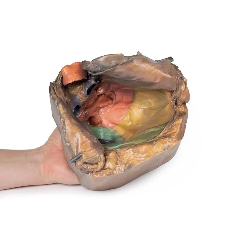 3D Printed Pericardial Space